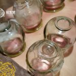 🔥 All About Cupping: The Ancient Detox Ritual Everyone’s Talking About (First Trial $58!)